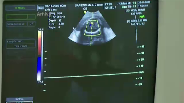 FOTO. Aparitie bizara langa bebelus, in timpul unei ecografii de sarcina