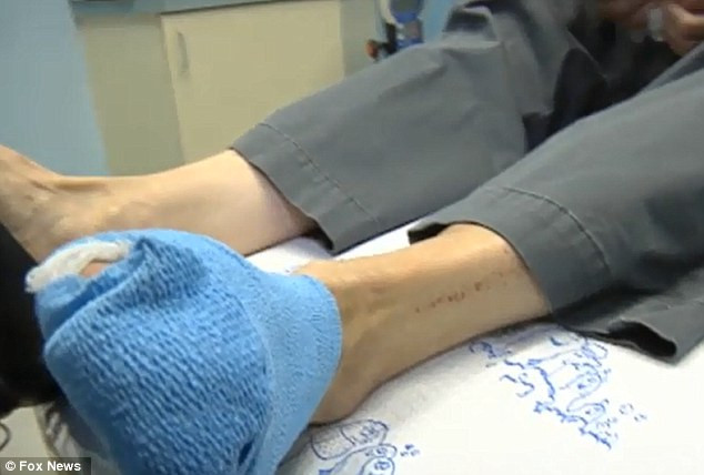 Ancheta in spitalul unde un medic ar fi inceput sa opereze o pacienta la piciorul sanatos