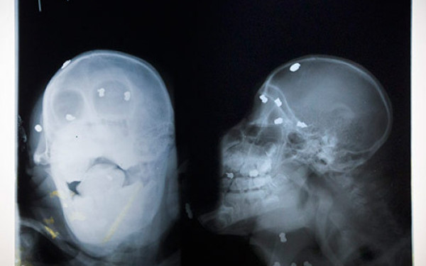 A fost impuscat de 62 de ori: Povestea urangutanului care refuza sa moara!