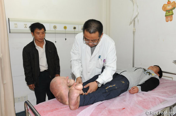 "Este doar in aparenta normal". Motivul pentru care toti copiii refuza compania acestui baiat. VIDEO