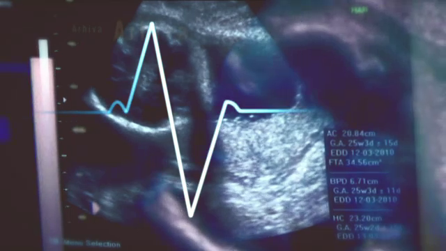 Detalii noi in cazul doctoritei care a strivit un bebelus sanatos. In 2007 era sa omoare o pacienta