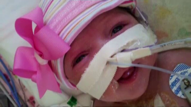 O fetita s-a nascut cu inima in afara corpului. Medicii, uimiti ca a supravietuit