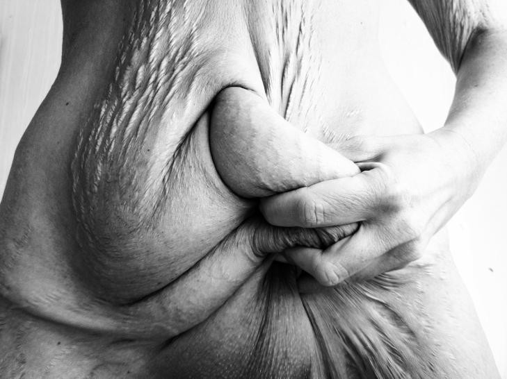 O femeie a decis sa arate lumii intregi pozele nud, dupa ce a slabit 50 kg. "Asta nu e frumusete"