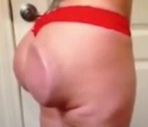 A mers la doctor sperand un posterior de model. "Si-a batut joc de mine. M-a mutilat". VIDEO