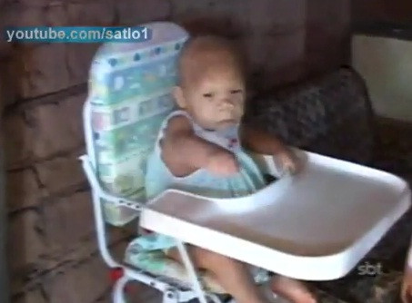 VIDEO. Are 31 de ani, dar arata si se poarta ca un bebelus de 9 luni. Boala ciudata a unei femei