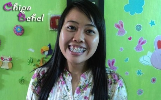 Dispuse sa-si riste viata pentru a fi la moda. Ce au ajuns sa faca femeile din China. FOTO