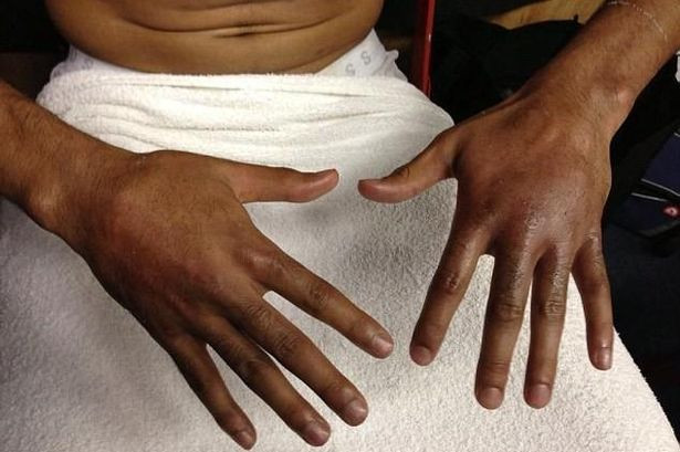 Mana umana a evoluat pentru ca omul sa poata sa loveasca cu pumnul