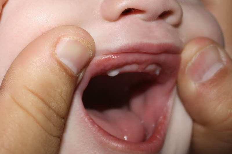 S-a uitat la dintii fiului sau si nu i-a venit sa creada. "Isi ataca colegii. Nu are niciun prieten"