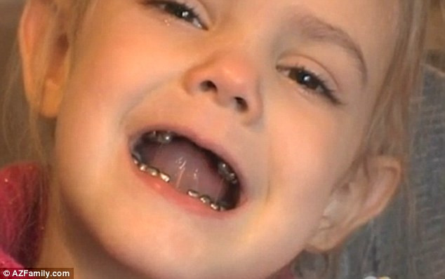 Cosmar pentru o fetita de 4 ani: cum arata dantura ei, dupa o vizita la dentist. VIDEO