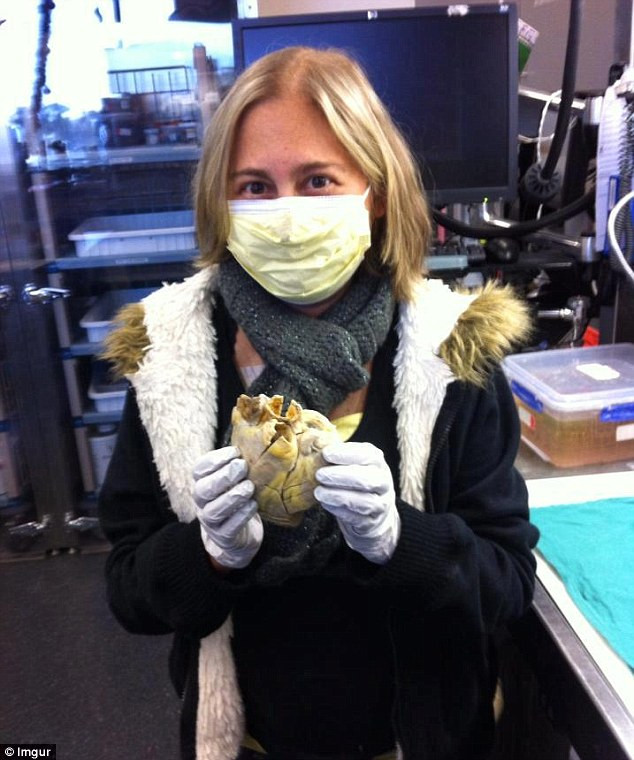 Momentul incredibil in care o pacienta a fost fotografiata cu propria inima in maini. FOTO