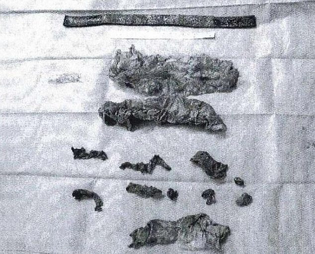 Ce au descoperit medicii in trupul unui barbat din Germania. "Este primul caz din istorie". FOTO