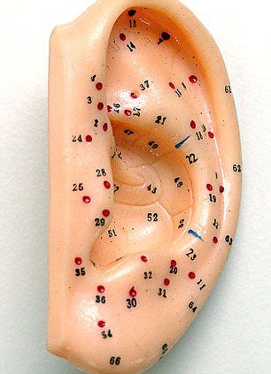 terapia auriculara