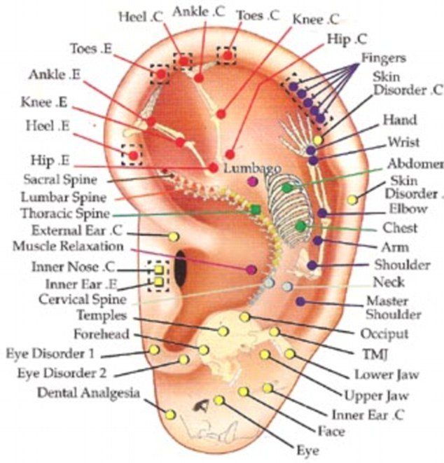 terapia auriculara