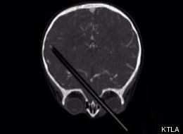 Radiografie