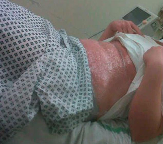 O adolescenta de 15 ani, in agonie la spital dupa ce a folosit o populara metoda de infrumusetare