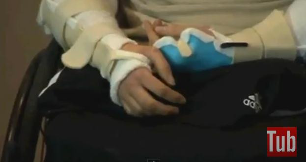 In urma cu 4 ani, viata lui era complet distrusa. Povestea tanarului care a uimit lumea medicala