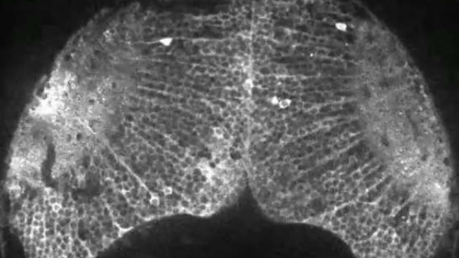 Cum se formeaza gandurile intr-un creier. Experiment filmat in premiera. VIDEO