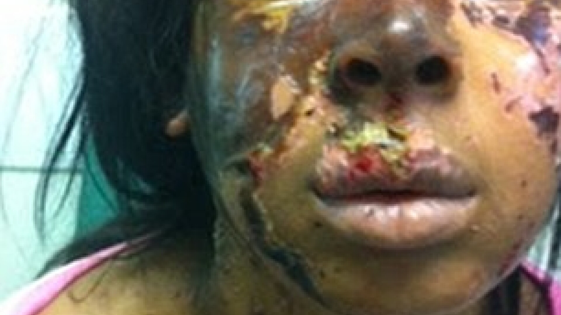 “Nu o sa mai fiu frumoasa”. Angajata Victoria’s Secret, desfigurata dupa un atac cu acid. FOTO