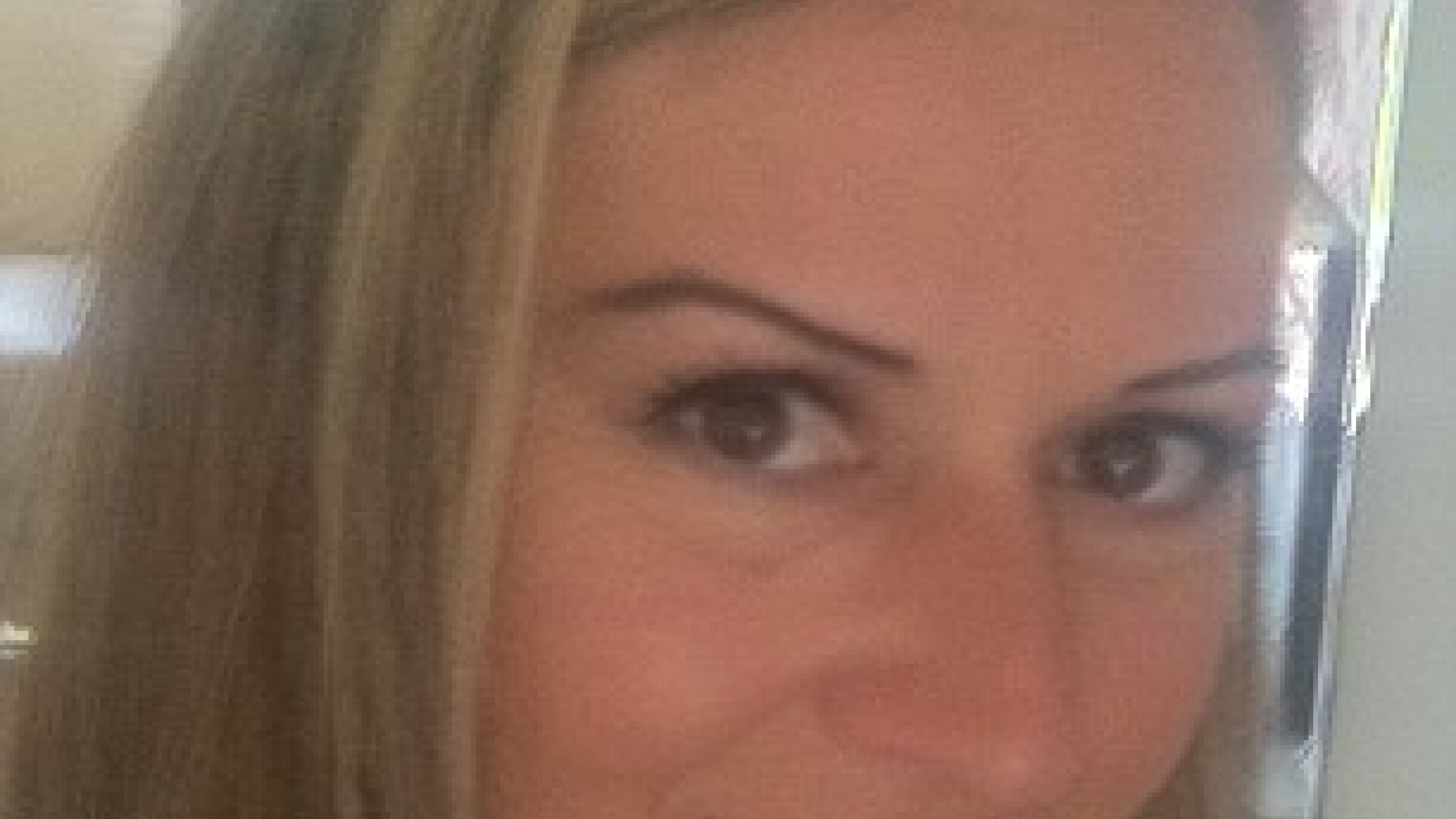 “Am vazut in oglinda un monstru”. Ce a patit o femeie dupa un tratament cosmetic banal