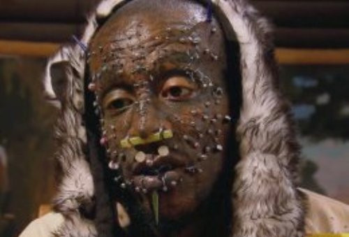 "Fiicei mele ii este teama sa ma priveasca" Cum arata omul cu un chip unic pe Pamant