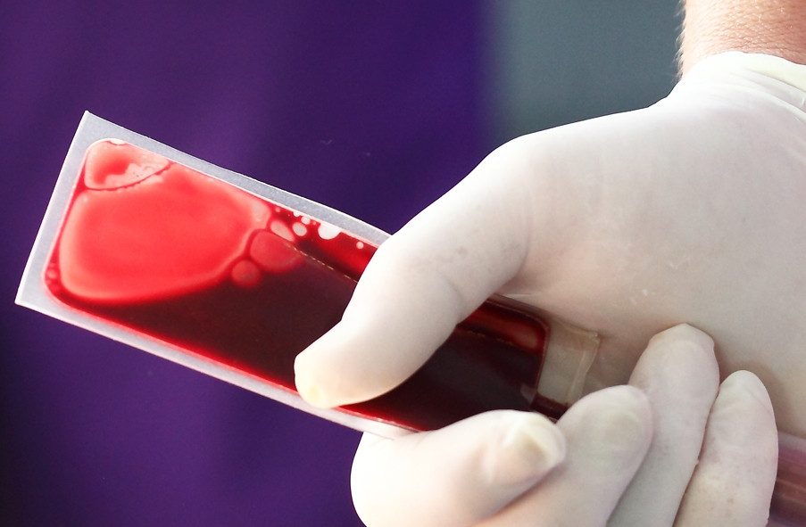 Ziua Internationala a Hemofiliei, sarbatorita si la Timisoara. 1.800 de romani au aceasta boala