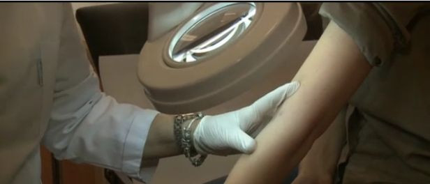 Mergeti la medic de indata ce observati pe piele leziuni noi. Acestea pot fi tumori