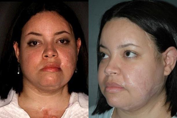 Femeia care a primit un nou chip dupa ce a fost injunghiata de 100 de ori: uite cum arata