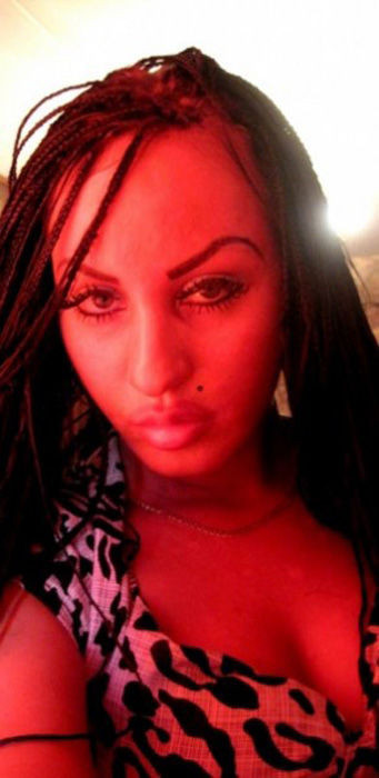 "Am vrut sa fiu perfecta si uite ce a iesit". Cum arata aceasta tanara dupa 13 operatii estetice