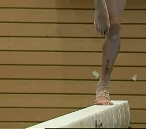 Plin de sange si vanatai: cum arata piciorul unei gimnaste romance de 14 ani