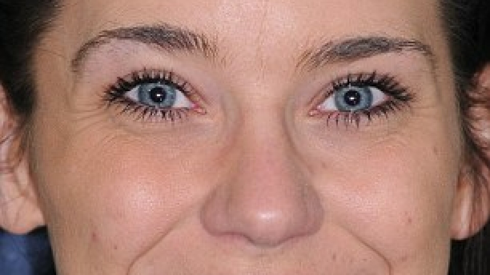 FOTO. La 25 de ani, refuza sa zambeasca din cauza dintilor. Transformarea este uimitoare