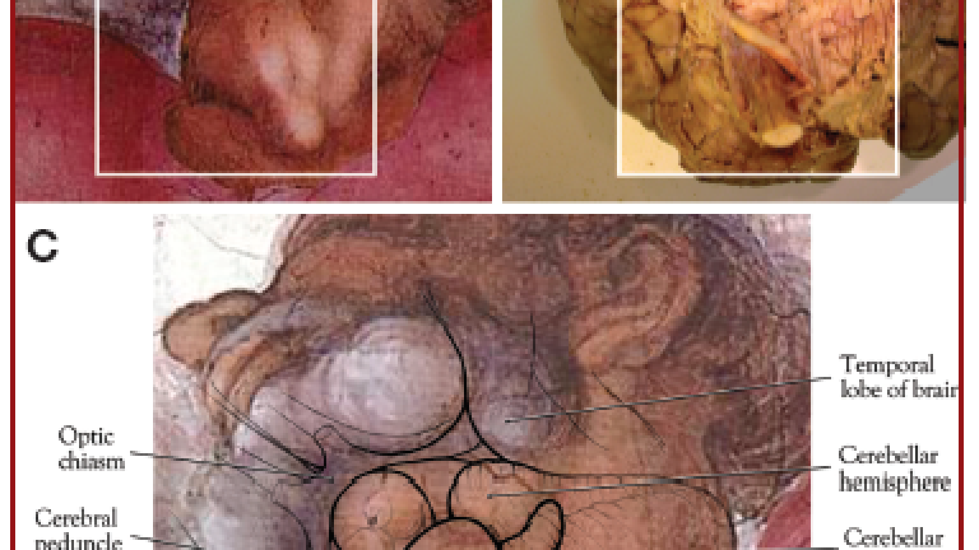 mesaj ascuns de Michelangelo in fresca