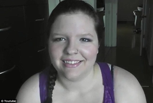 Boala ciudata care afecteaza peste 1 miliard de oamen din intreaga lume. "Ma simt ca un vampir"