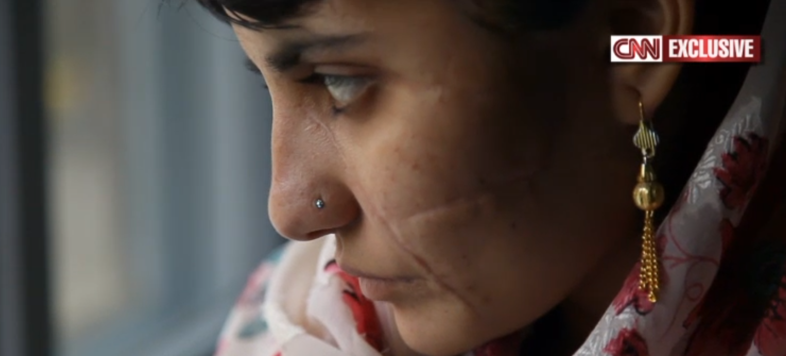 Familia a maritat-o fortat la 12 ani cu un barbat de 60 de ani. Cum a ajuns desfigurata pe viata