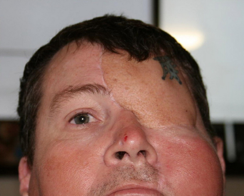 Explicatia uluitoare din spatele acestei fotografii. Ce are barbatul in locul ochiului stang