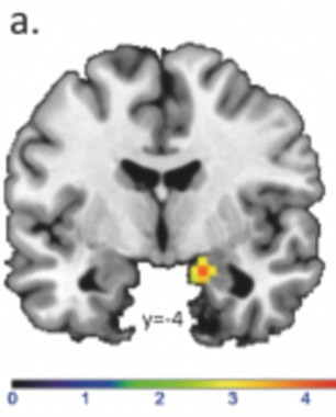 Imaginile care dezvaluie de ce barbatii nu pot intelege femeile. Ce spun cercetatorii