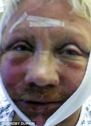 A vrut sa arate bine pentru sotul ei.Cand s-a trezit din operatie insa, nu s-a recunoscut in oglinda