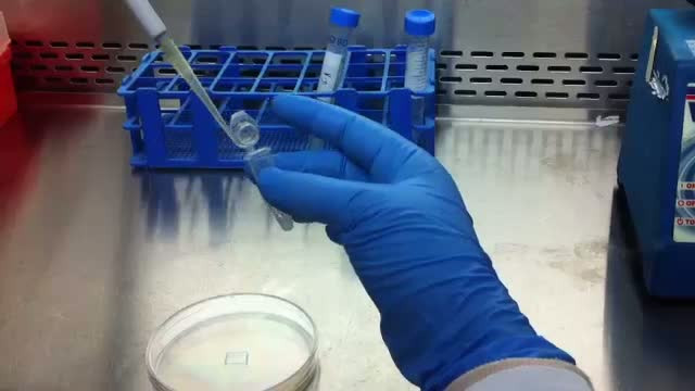 Industria din farfurie, partea II. Bolile pe care hrana artificiala ni le poate provoca