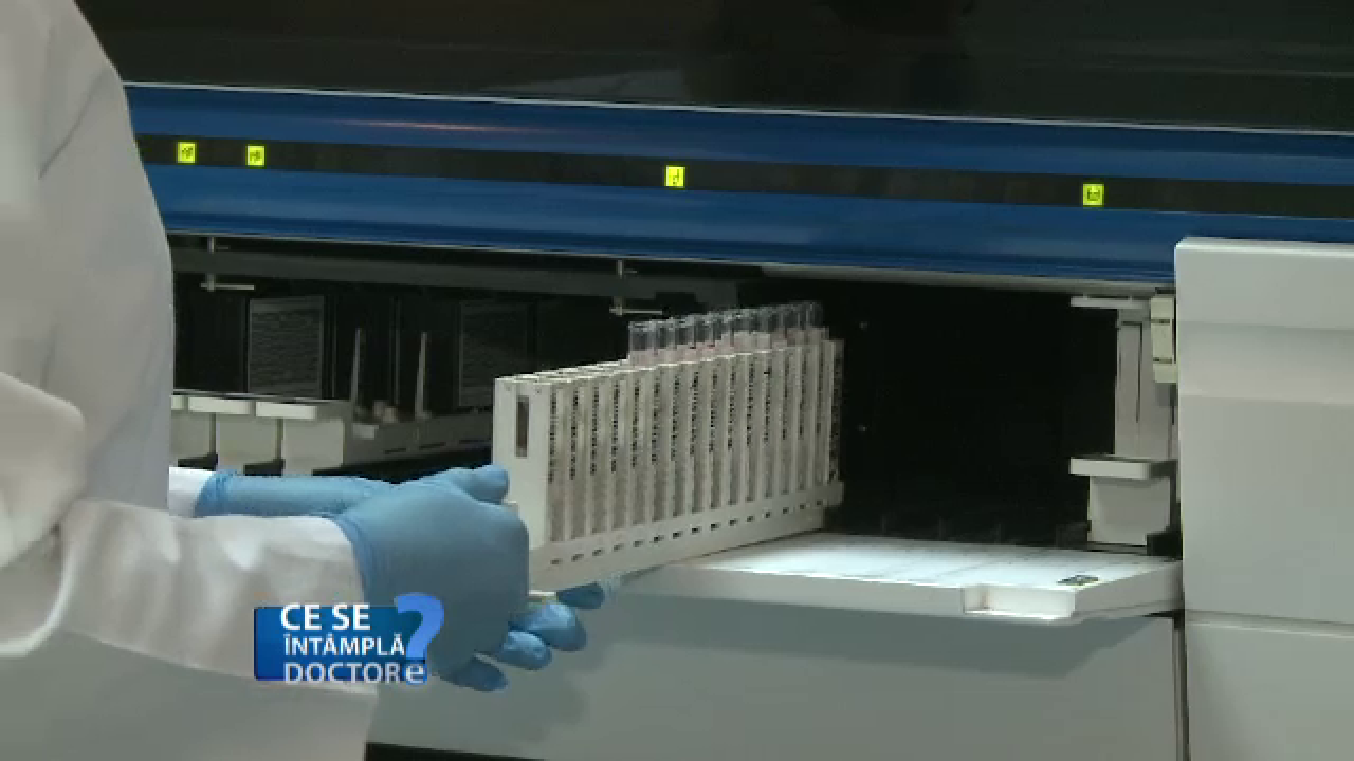 Genele care determina alergiile se transmit. Ce sfaturi au medicii pentru parinti