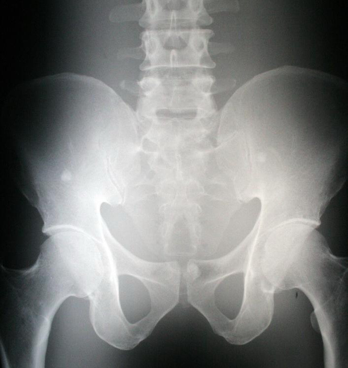 A ajuns la spital cu dureri ingrozitoare. Medicii au fost socati cand i-au vazut radiografia