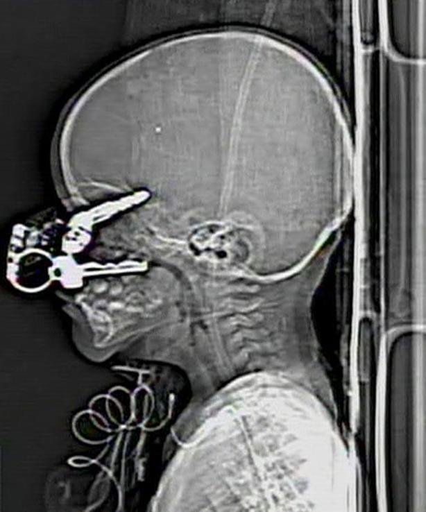 radiografie