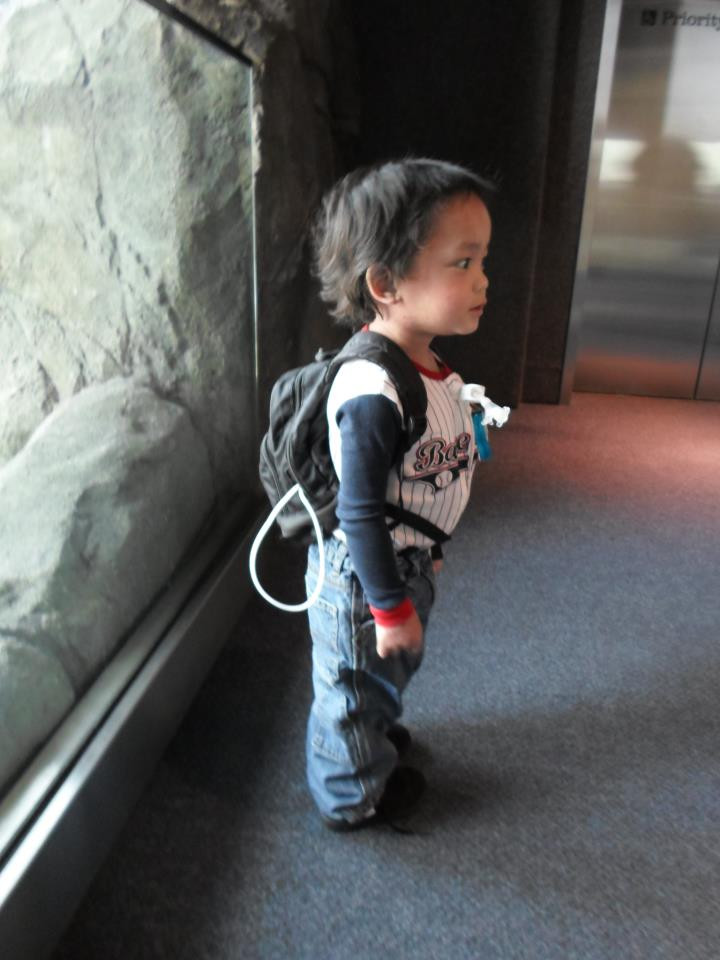 Un copil de 3 ani e alergic la absolut toate alimentele. Cum reuseste sa ramana in viata. FOTO