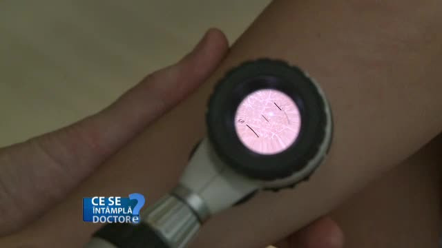 Cum arata leziunile grave ale pielii care nu par agresive. Sfatul dermatologilor