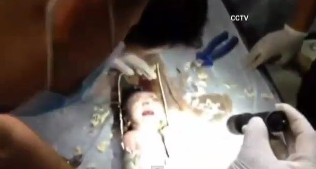 Bebelus din China, salvat dintr-o conducta de canalizare, dupa o operatiune spectaculoasa. VIDEO