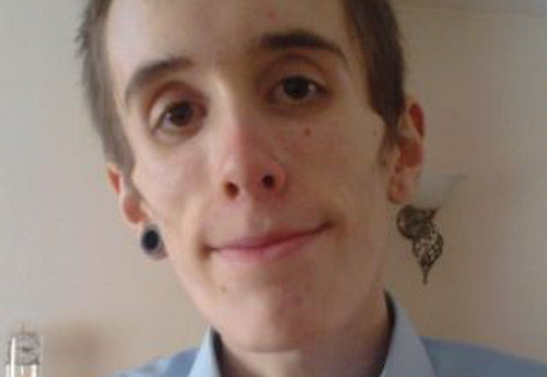 A fost "mort" 20 de minute, insa asta i-a salvat viata. Tanarul care s-a infometat timp de 4 ani