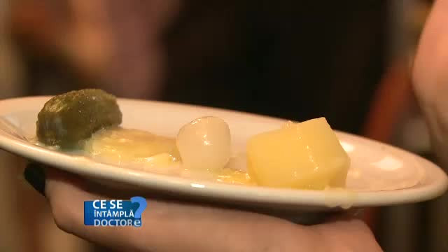 Atentie la sortimentele de branzeturi pe care le consumati. Dozele recomandate de nutritionisti