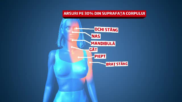 Tanara din Brasov stropita cu o substanta chimica de fostul iubit risca sa ramana mutilata pe viata
