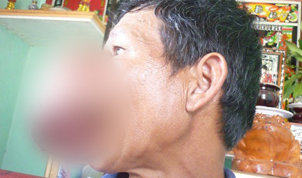 Are cosmaruri ori de cate ori se uita in oglinda. Cum arata "omul cu fata de demon". FOTO