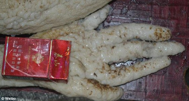 Exemplul medicilor reveniti in tara care opereaza fara spaga. Toate atentiile se duc pe aparatura