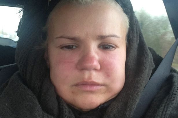 FOTO. Si-a facut un tratament cosmetic, dar acum arata ingrozitor. "Nu ma recunosc in oglinda"