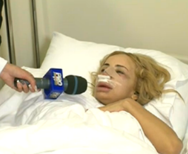Daniela Gyorfi s-a operat la nas. Pe patul de spital, artista este de nerecunoscut